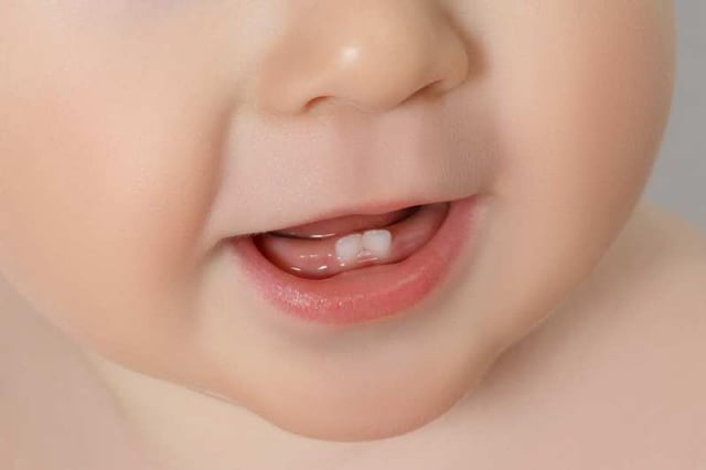 Trẻ bị kích thích do mọc răng sẽ khó ngủ ngon