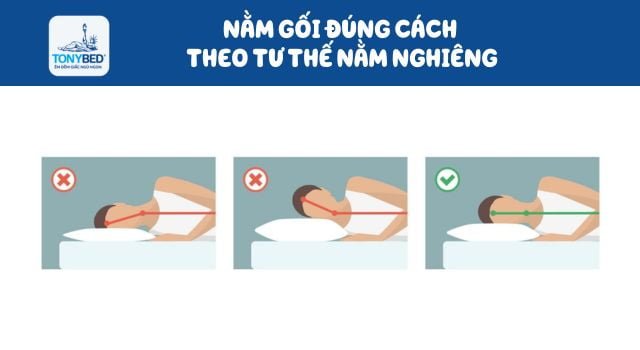 Cách kê gối khi ngủ đúng cách cho người nằm nghiêng tránh bị đau mỏi cổ