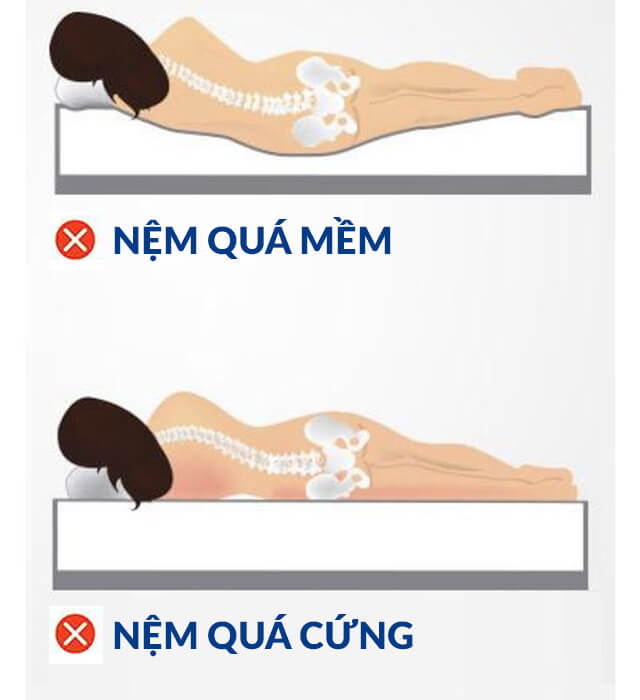 Cách hạn chế bị đau lưng khi nằm nệm lò xo