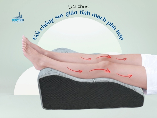 Lua chon goi chong suy gian tinh mach cho phu hop