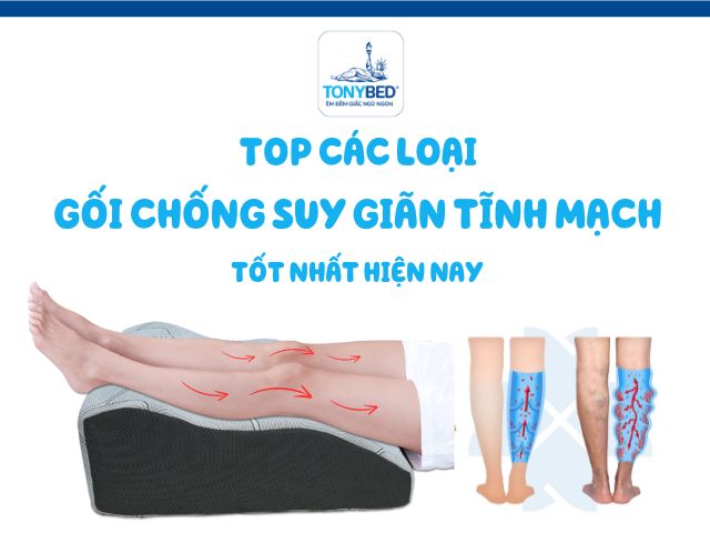 Các loại gối chống suy giãn tĩnh mạch tốt