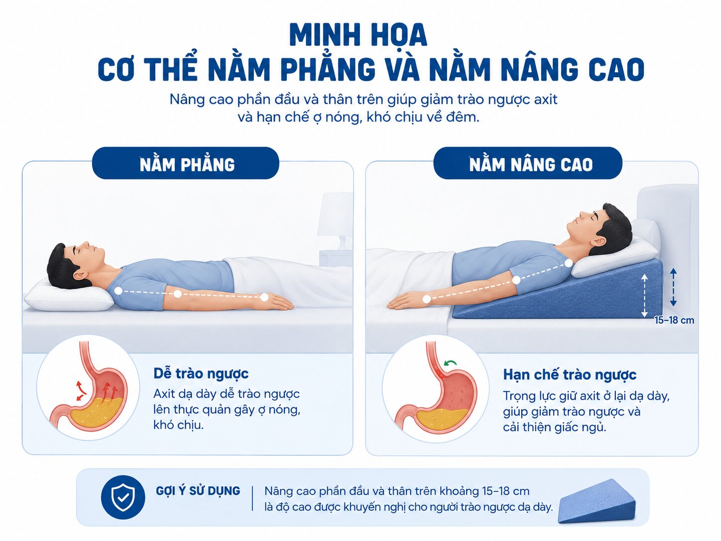 cơ chế gối chống trào ngược