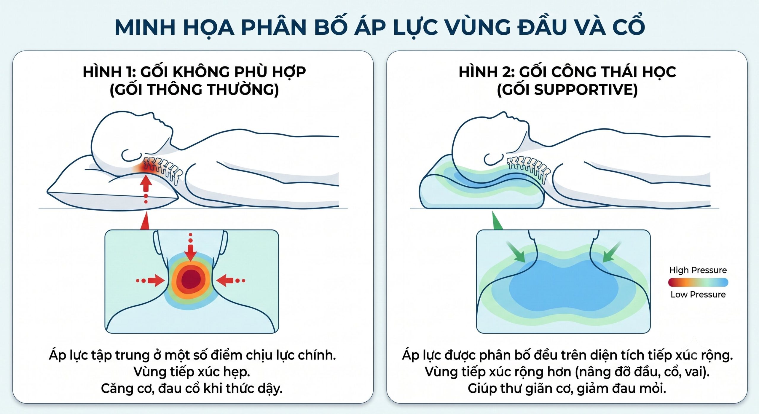 gối công thái học giúp phân bố áp lực đầu và cổ